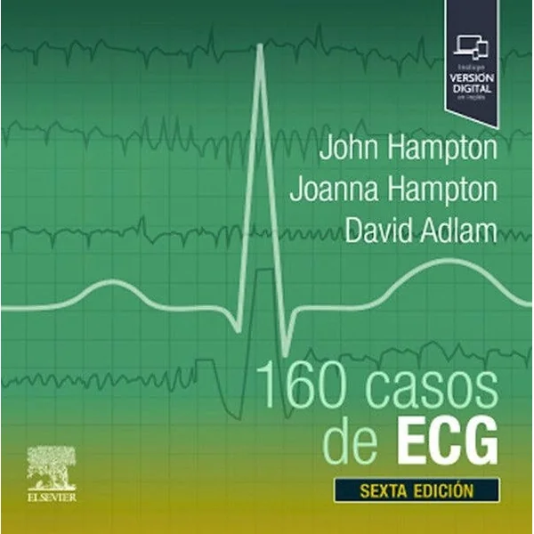 160 Casos de ECG