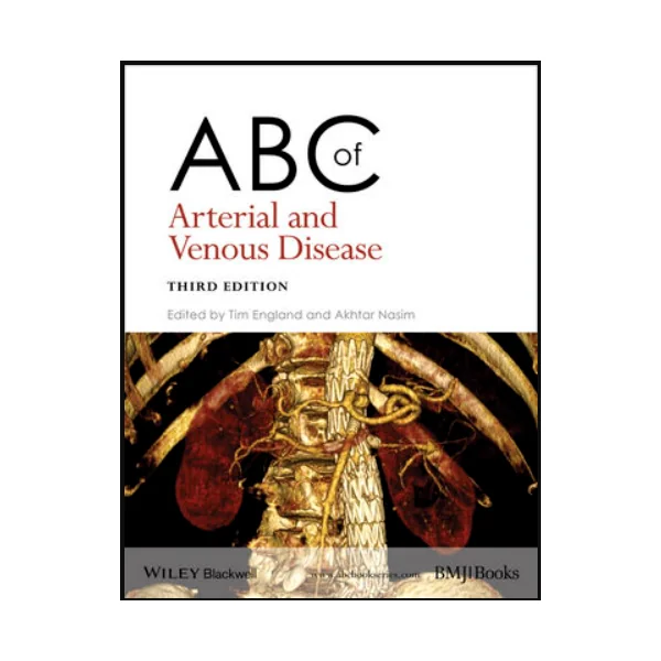 ABC of Arterial and Venous Disease