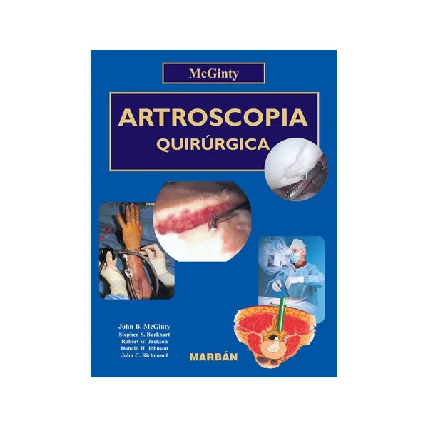 Artroscopia Quirúrgica