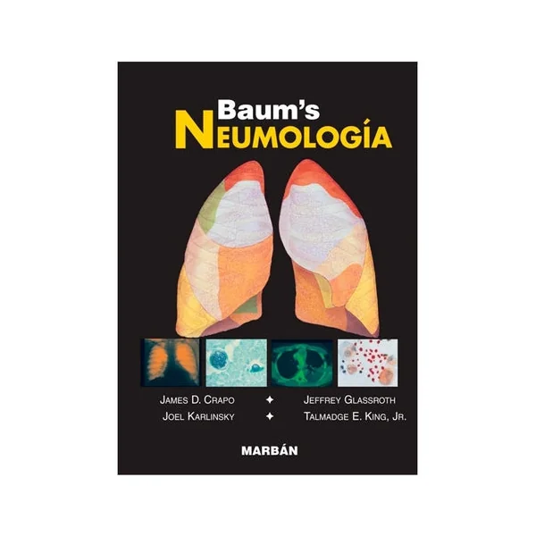 BAUM´S Neumología - Pocket