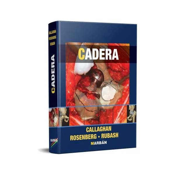 Cadera