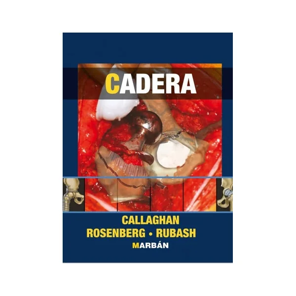 Cadera - Imagen 2