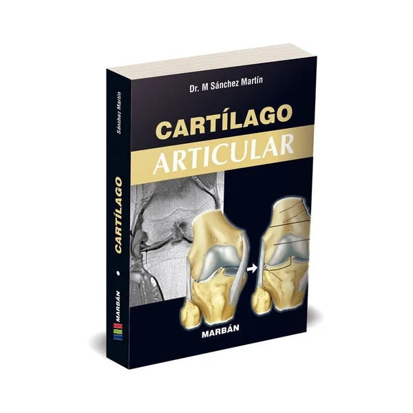 Cartílago Articular