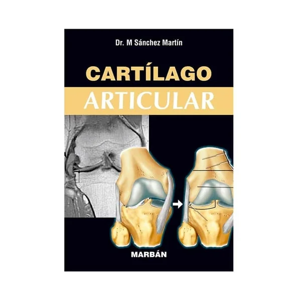 Cartílago Articular - Imagen 2