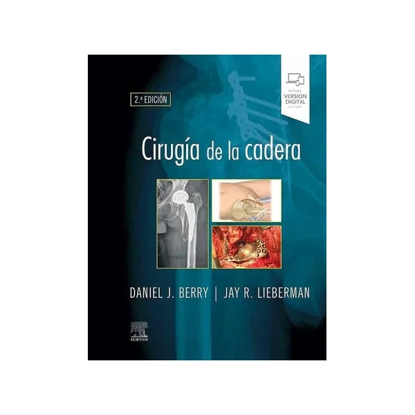 Cirugía de la Cadera