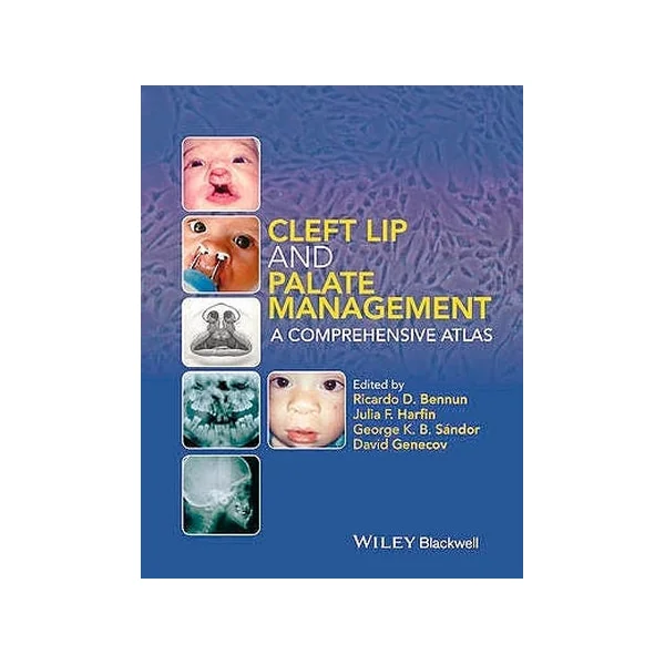 Cleft Lip and Palate Management: A Comprehensive Atlas