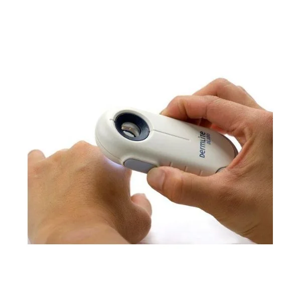 Dermatoscopio DL100 Dermlite - Imagen 2