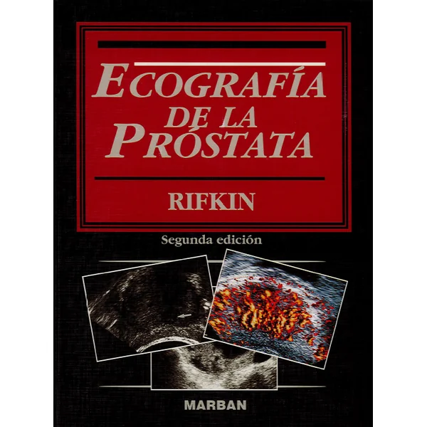 Ecografía de la próstata