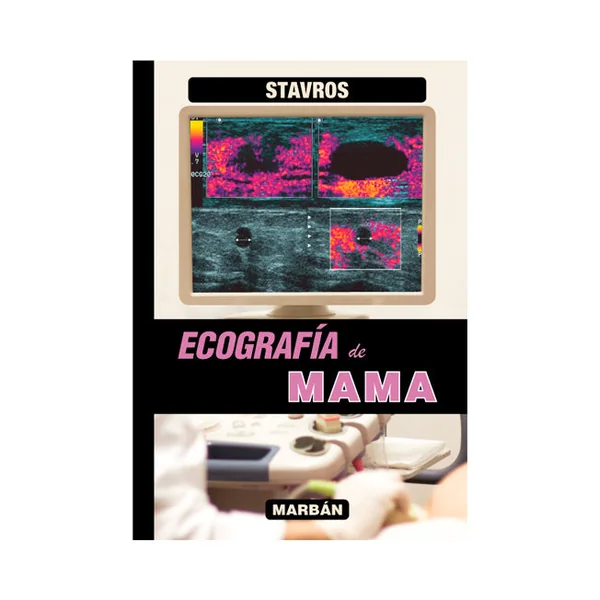 Ecografía de Mama