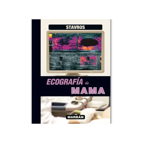 Ecografía de Mama - Imagen 2