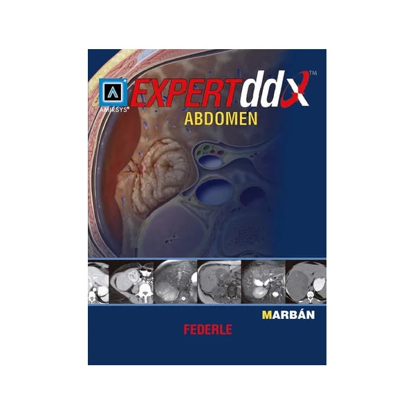 Expert DDX Abdomen - Amirsys