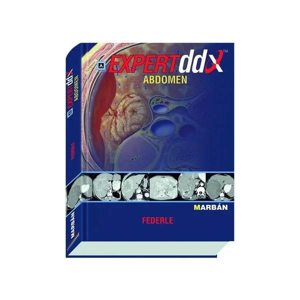 Expert DDX Abdomen - Amirsys - Imagen 2