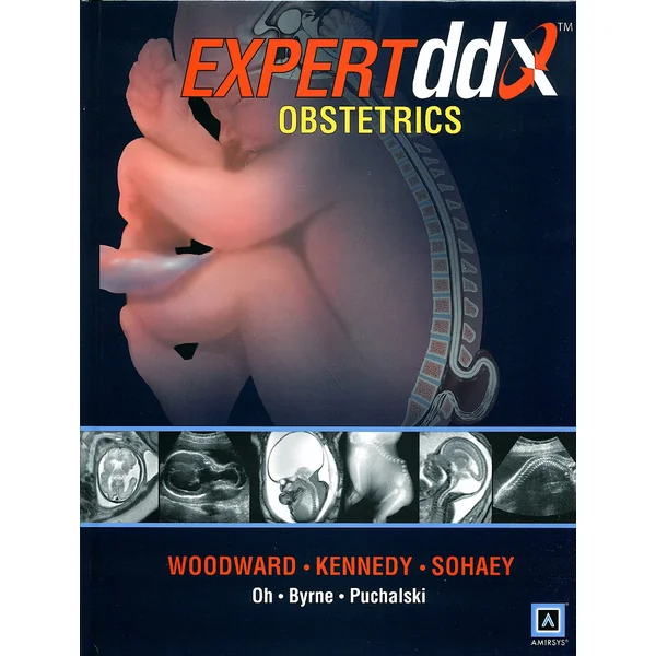 Expert ddx obstetrics