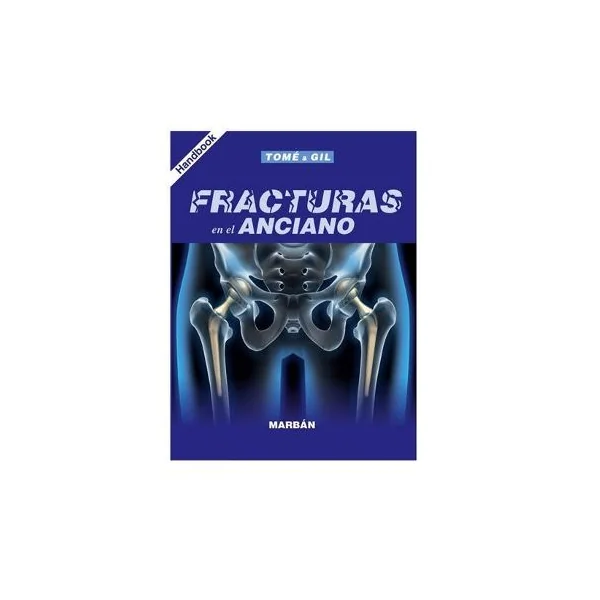 Fracturas en el Anciano - Handbook