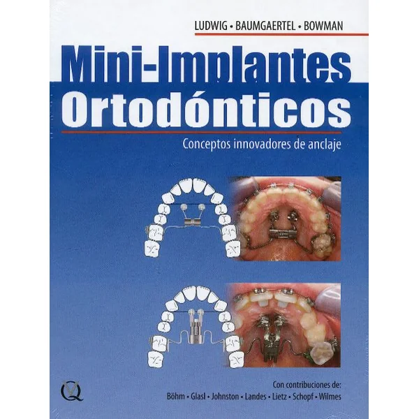 Mini-Implantes Ortodónticos