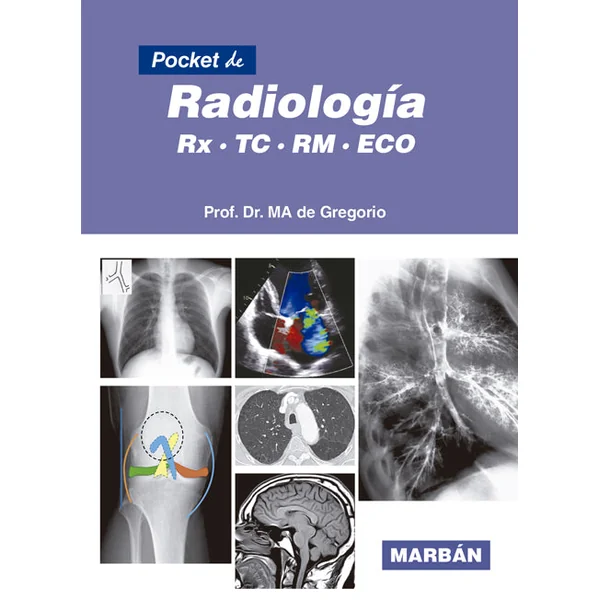Pocket de Radiología - De Gregorio - Imagen 3