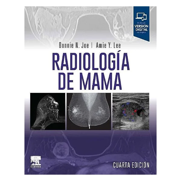 Radiología de Mama