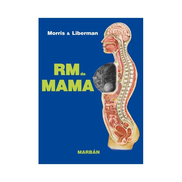 RM de Mama