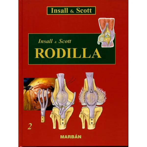 RODILLA - Insall & Scott 2Vol. - Premium - Imagen 3
