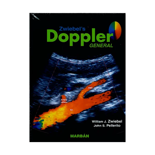 Zwiebel’s Doppler general Premiun TD